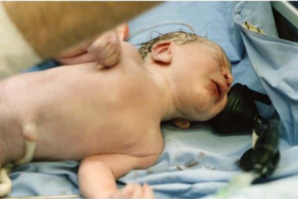 רשלנות רפואית הולדה בעוולה - נתן ראט ושות'